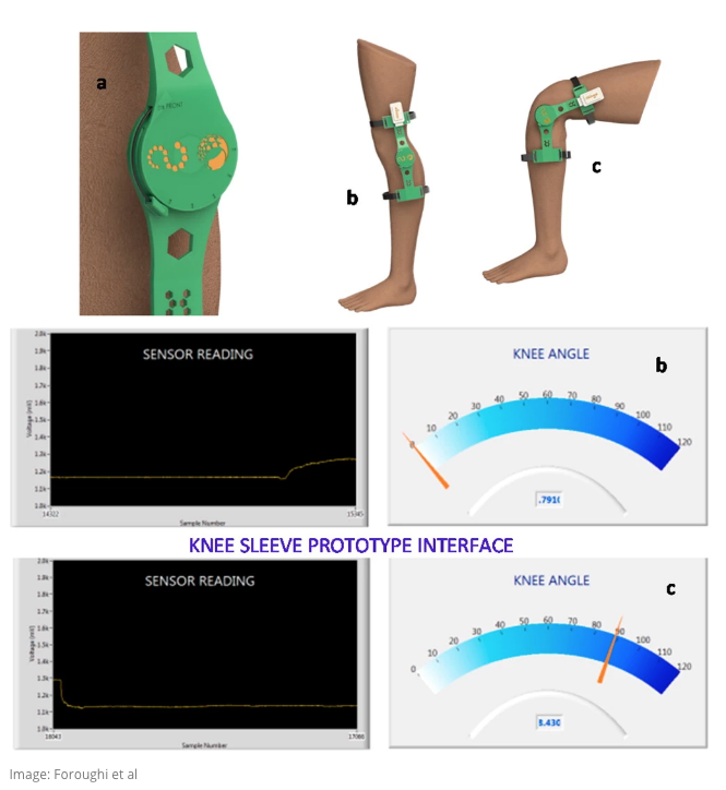 An image of sensor measurements that can determine when a knee is bent or straight